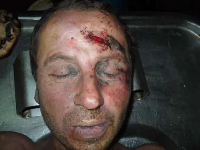Правоохоронці затримали двох підозрюваних у вбивстві чоловіка, тіло якого знайшли у лісосмузі — фото 4